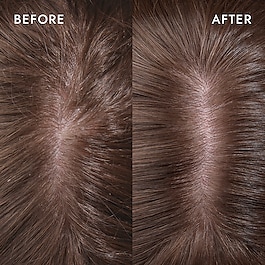 Cure Scalp Serum - Scalp Restoring Formula